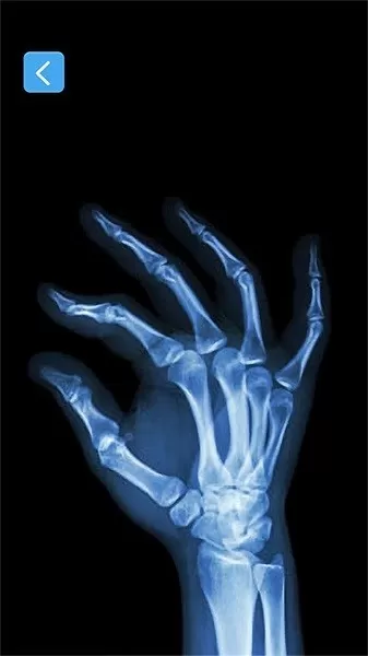 x射线模拟器官网手机版