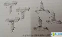 海绵体硬结症怎么治疗