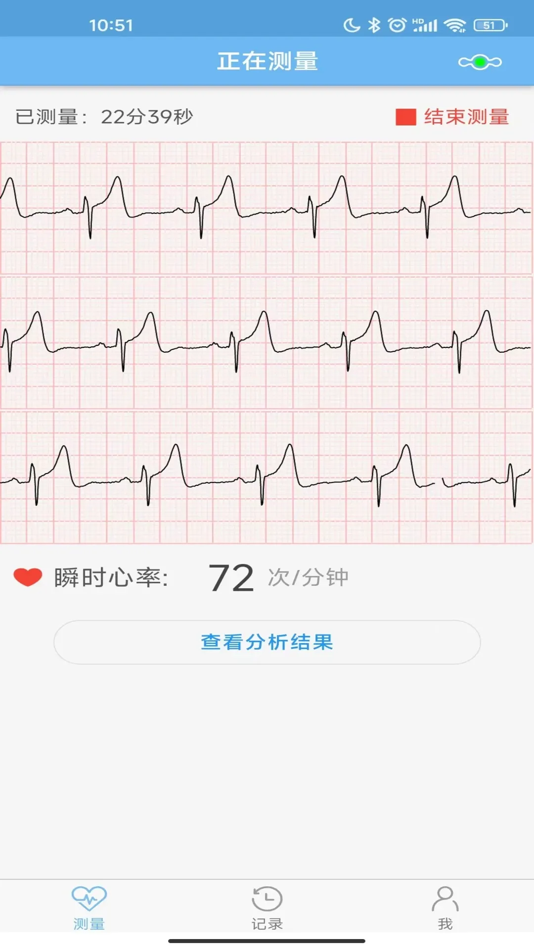 数维康心电下载官网版